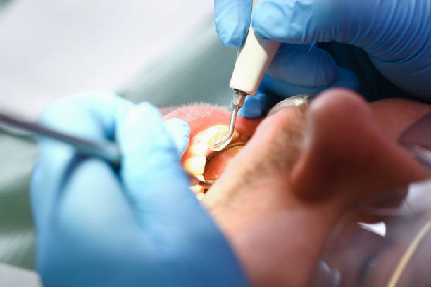 Best Emergency Orthodontic Repairs in Orland, CA
