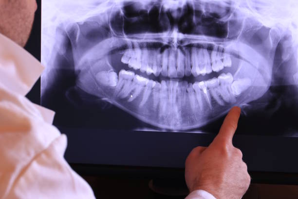 Best Emergency Denture Repair in Orland, CA